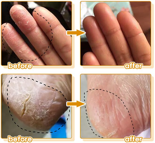 华博士研发的身体乳“学霸”成分抹了！pg电子免费模拟器干到发痒？一群清(图4)